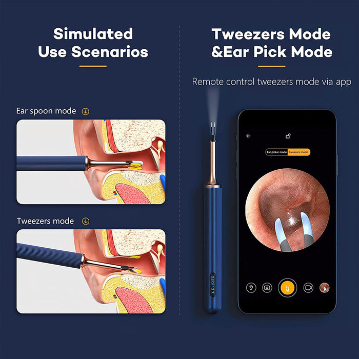 Bebird Note 3 Pro 智能耳朵清洁棒耳垢清除工具 - 蓝色