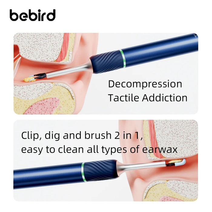 Bebird Note5 Pro 智能可视耳朵清洁棒 耳垢清除工具 - 白色